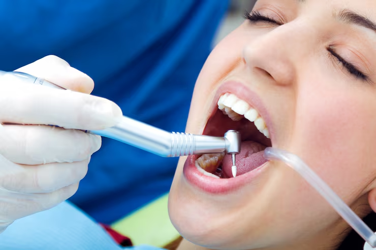Soft Tissue Graft Around Implants: When Is It Needed and How Does It Work?